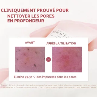 skin1004-پوره‌مایزینگ-فوم-شستشوی-عمقی-سنتلا-پاکسازی-منافذ-99-32-درصد